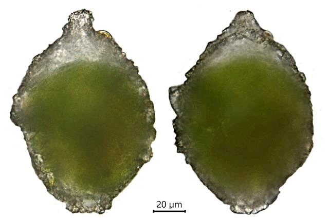 Difflugia difficilis