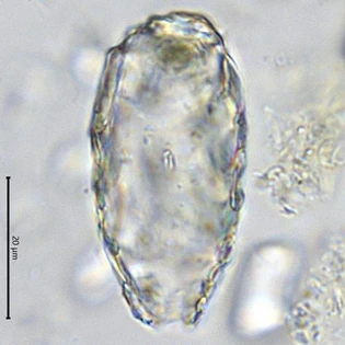 Difflugia fusiforma