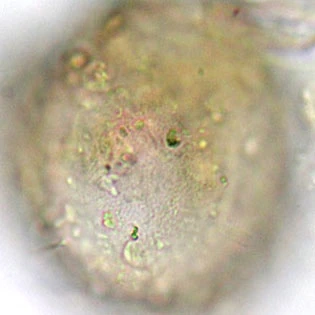 Difflugia louisi