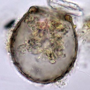 Difflugia louisi