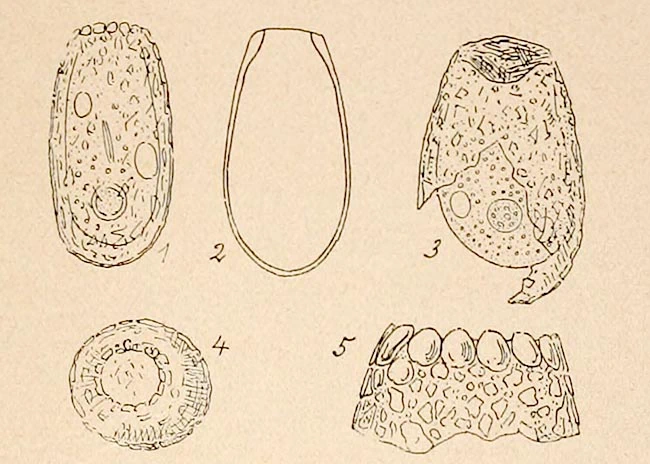 Difflugia glans
