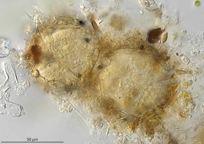Difflugia globulosa