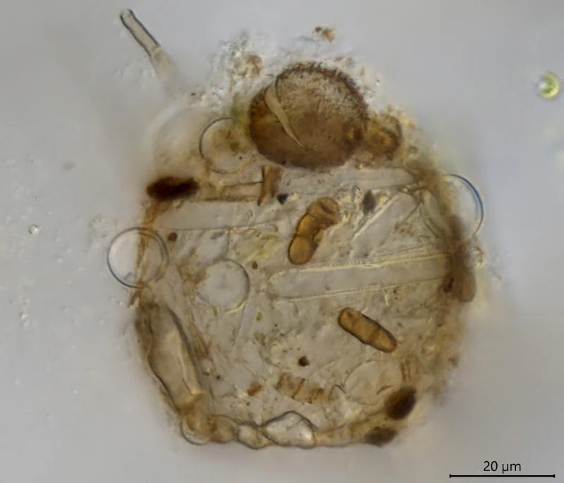 Difflugia globulosa