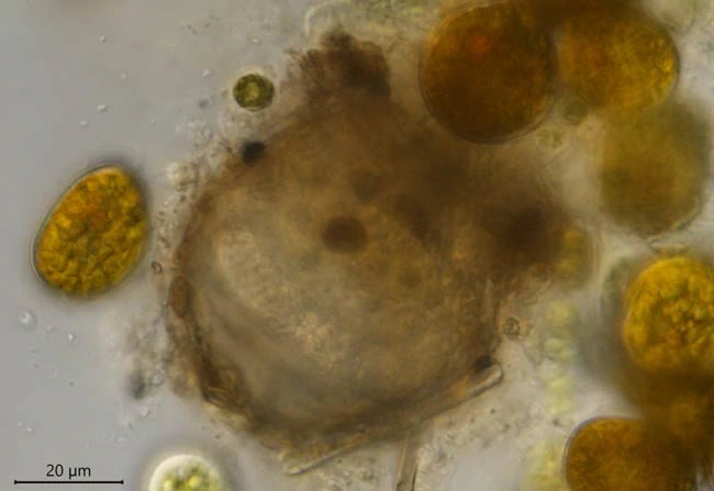 Difflugia globulosa
