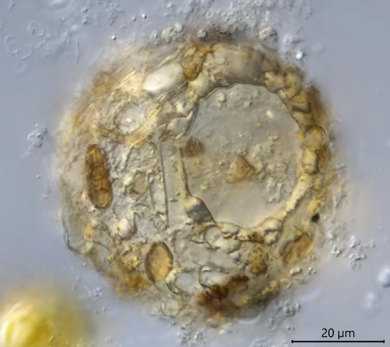 Difflugia globulosa