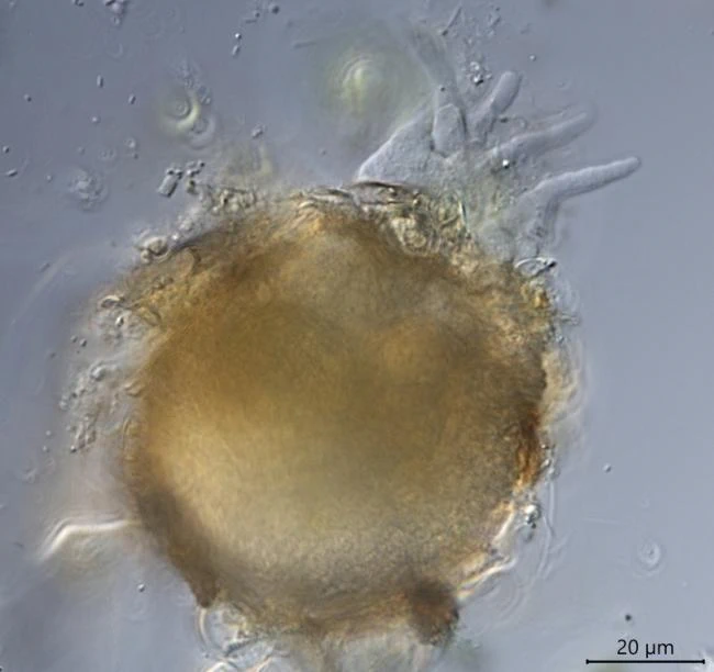 Difflugia globulosa