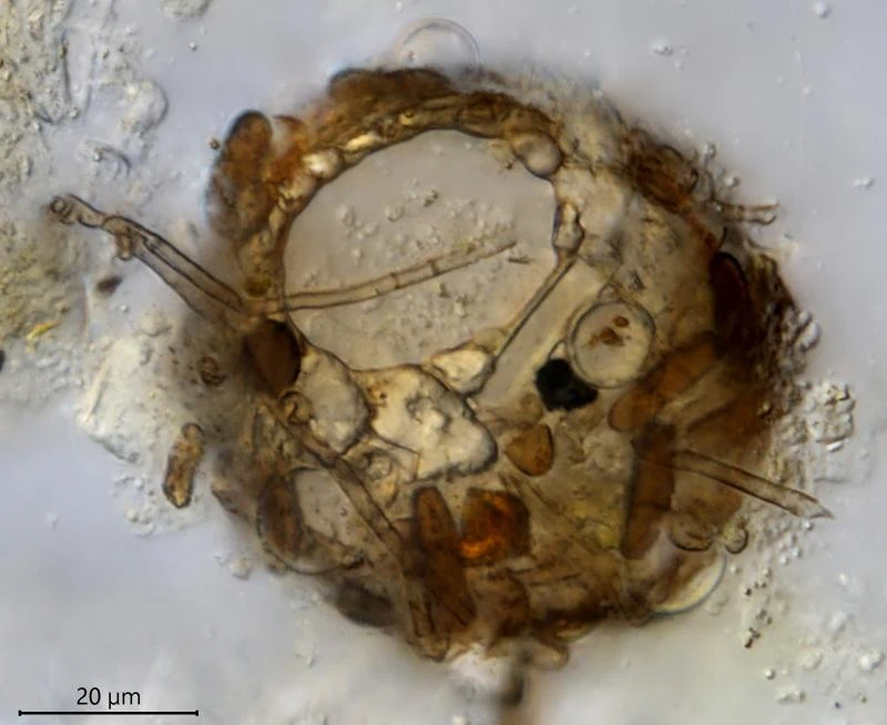 Difflugia globulosa