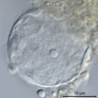 Cylindrifflugia lanceolata