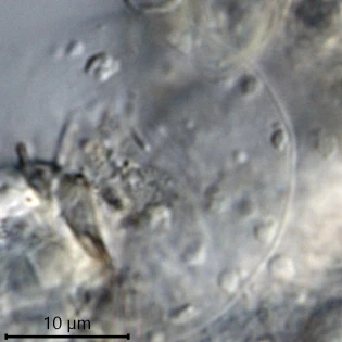 Cylindrifflugia lanceolata