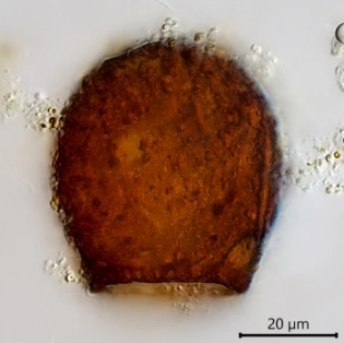 Difflugia louisi
