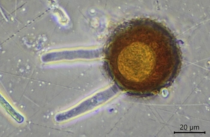 Difflugia louisi