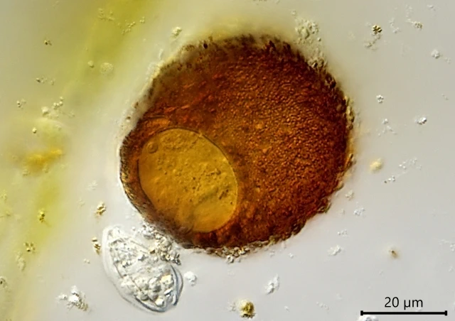 Difflugia louisi