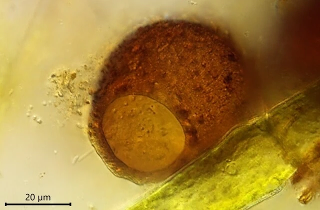 Difflugia louisi