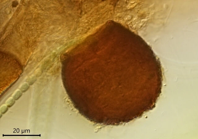 Difflugia louisi
