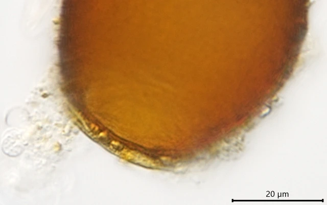 Difflugia louisi