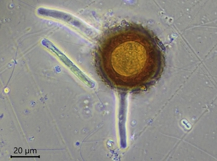 Difflugia louisi