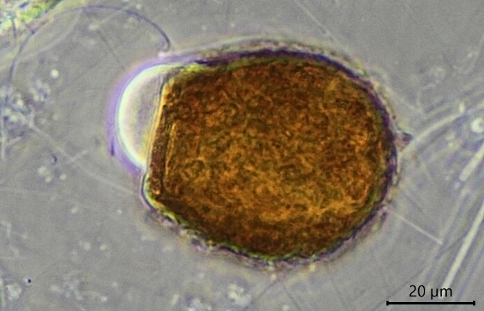 Difflugia louisi
