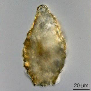 Difflugia mammillaris