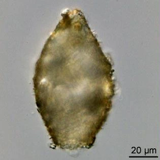 Difflugia mammillaris