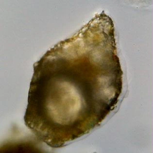 Difflugia mammillaris