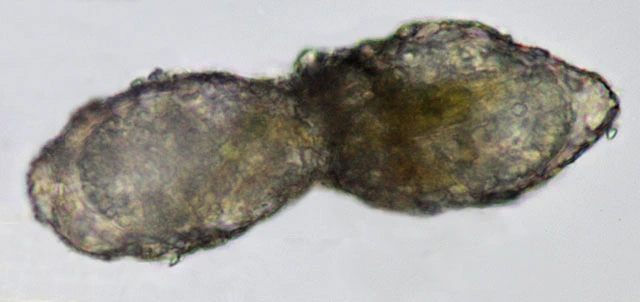 Difflugia mammillaris