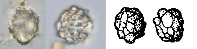 Difflugia nana