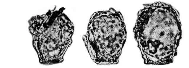 Difflugia ovalisina