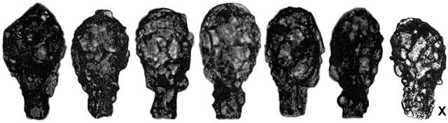 Difflugia pyriformella