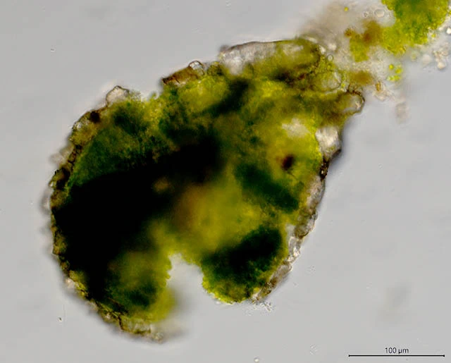 Difflugia pyriformis