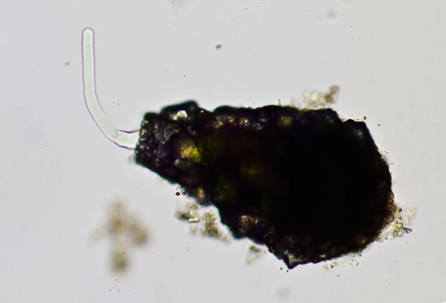 Difflugia cf pyriformis