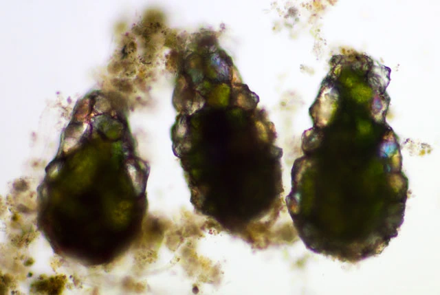 Difflugia cf pyriformis