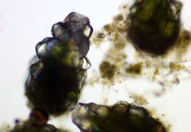 Difflugia cf pyriformis