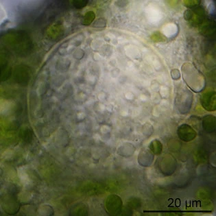 Difflugia pyriformis