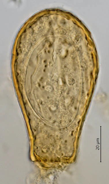Difflugia rubescens pseudostome