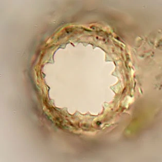 Difflugia rubescens pseudostome