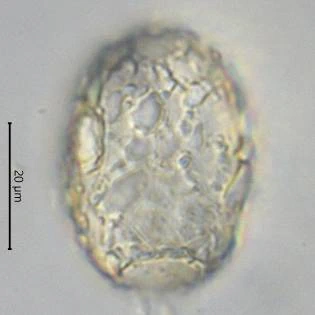 Difflugia saxicola