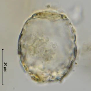 Difflugia saxicola