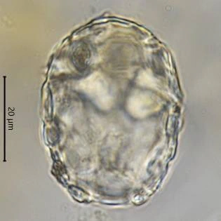Difflugia saxicola