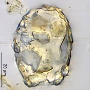 Difflugia saxicola