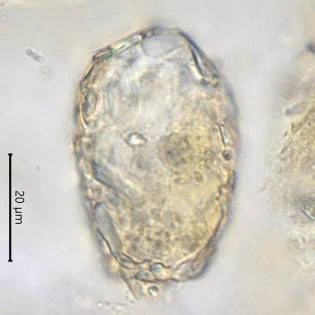 Difflugia saxicola