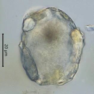 Difflugia saxicola