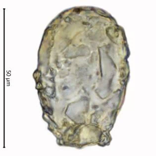 Difflugia saxicola