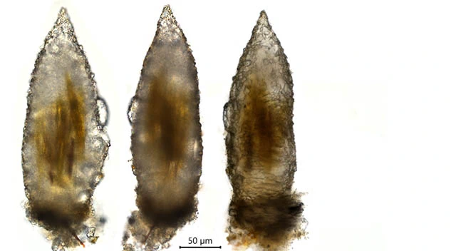 Difflugia scalpellum