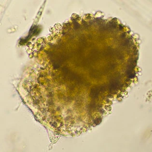Diplochlamys