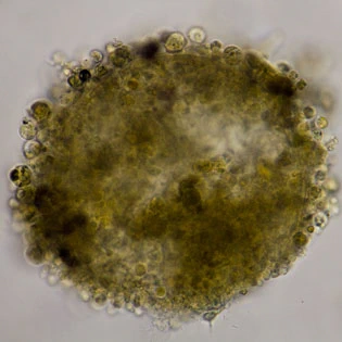Diplochlamys