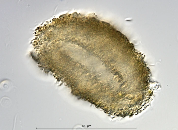Diplochlamys vestita