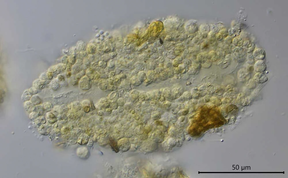 Diplochlamys vestita