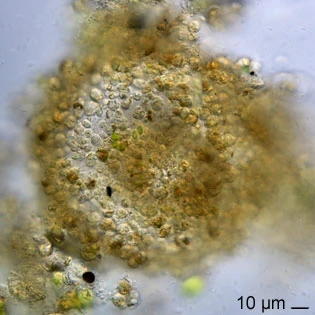 Diplochlamys vestita