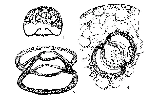 Distomatopyxis couillardi