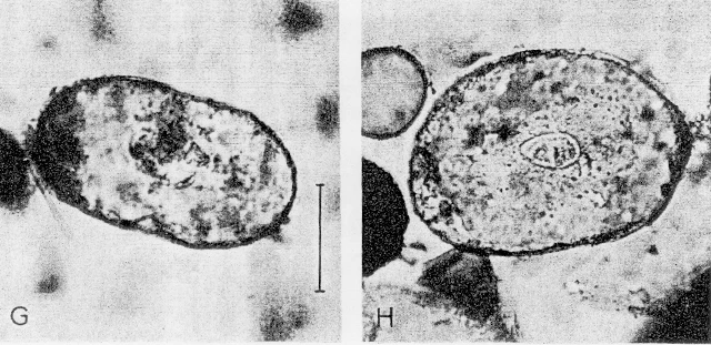 Elipsopyxis pauliani